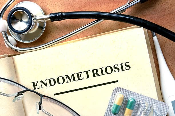Endometriosis concept. Book with stethoscope and pills. pain from endometriosis